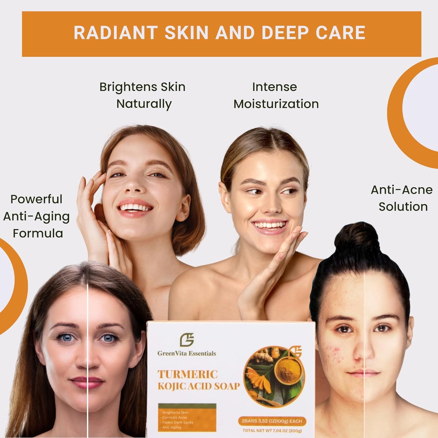 Turmeric Kojic Acid Soap- Skin and Body Brightening with Glycerin, Retinol & Hyaluronic Acid. Dark Spot Removal & Even Skin Tone.(Pack of 2) 100g each