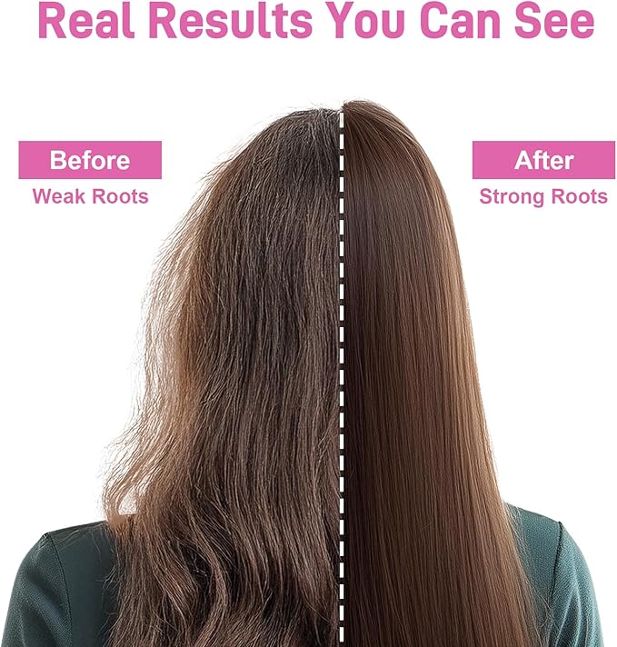 Sugar Free Beauty Gummies, Hair Skin and Nails Gummies with Vitamins A C E, Natural 6000mcg Biotin Gummies for Women Men, GMO Free, Gluten Free (Strawberry, 60 Count)