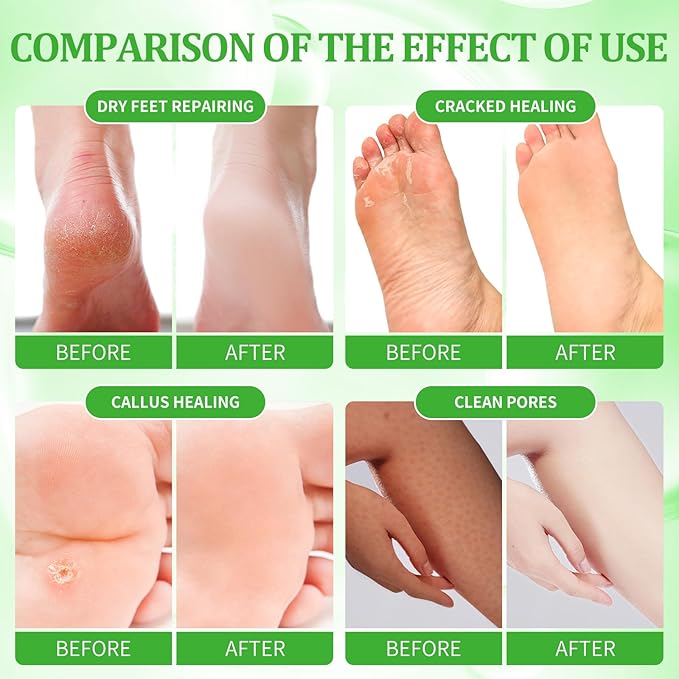 Pedicure Kit Foot Soak Set: Bubble Salt, Sugar Scrub, Massage Mask, Massage Lotion in a Box, 4 Step Foot Spa Kit for Dry Feet,Tired Feet（1 Set Lemon)