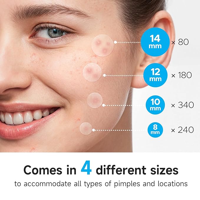 Acne Pimple Patch(840 Counts 4 Sizes), Zit Stickers for Face, Hydrocolloid Spot Stickers, Clear Acne Dots for Covering Zits, Blemishes, and Breakouts