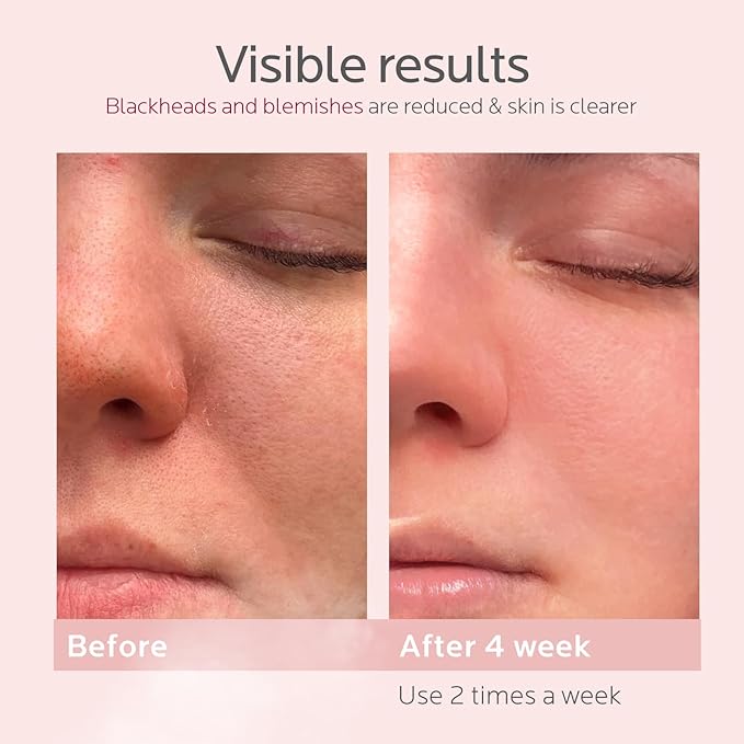 Colorfarm Facial Steamer Skin Care Kit: Face Steamer Home Spa Deep Cleaning Unclogs Pores with 6 Skin Care Tools - Relaxing Self Care Gifts for Women (Face Lifting & Sculpting Firming Skincare Set)