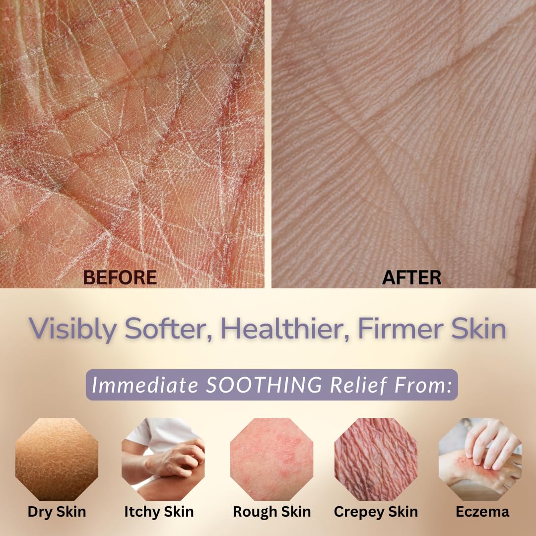 Natural Escapes Lavender Body Lotion for Dry Sensitive Skin, Eczema Relief Moisturizer with Aloe Vera, Olive Oil, Ceramides, Vitamin B5 and E, Hand and Body Cream for Women and Men, 8oz