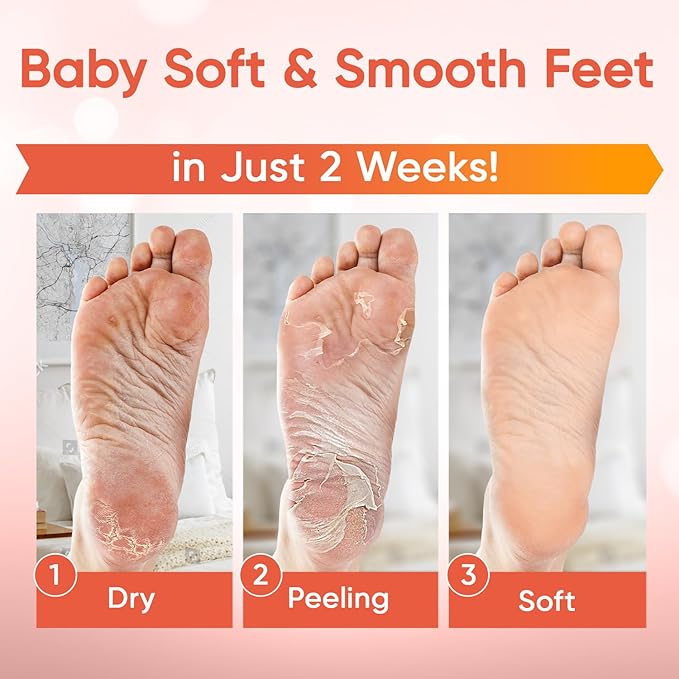 Foot Peel Mask - Foot Mask for Baby Soft Skin - Remove Dead Skin, Dry, Cracked Feet & Callus, Foot Spa, Made with Aloe Vera Extract for Women and Men (3 Pairs Peach)