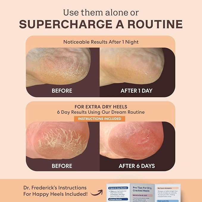 Dr. Frederick's Original Moisturizing Fuzzy Heel Socks - 2 Pairs - Cozy Gel-Lined Sleep Socks for Women & Men - Soothes Dry, Cracked Feet - Heel Repair - Peach Fuzz