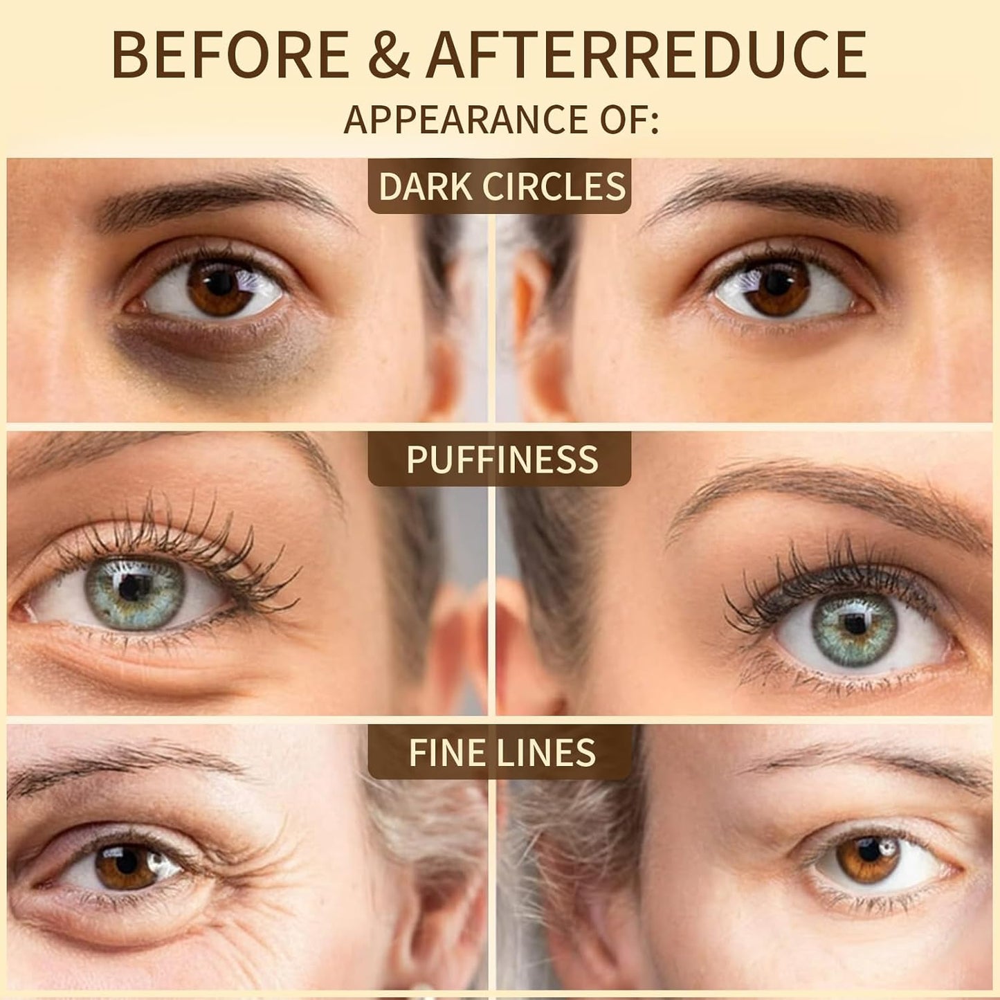 Collagen Eye Mask 60 Pairs - Milk Protein & Hyaluronic Acid Eye Patches for Dark Circles, Puffiness, Wrinkles - Hydrating Under Eye Treatment with Niacinamide & Aloe Vera - Cruelty Free Skincare