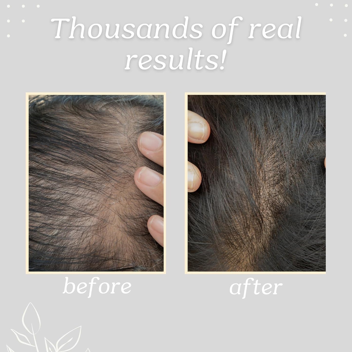 Batana Oil for Hair Strength, 100% Pure & Natural from Honduras, Promotes Hair Wellness for Men & Women