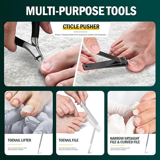 FVION Ingrown Toenail Tools Kit 5 Pcs, Toenail Clippers for Thick & Ingrown Nails, Ingrown Toenail Removal Correction Nail Clippers, Nail File Lifter, Professional Manicure Pedicure Tools