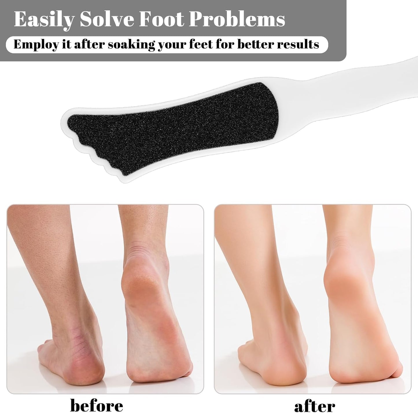 10 Pack Foot File Callus Remover with Double Sided Pedicure Tools for Feet Professional Sander for Dead Skin Foot Scrubber Rasp for Women Men Family Feet Beauty Spa