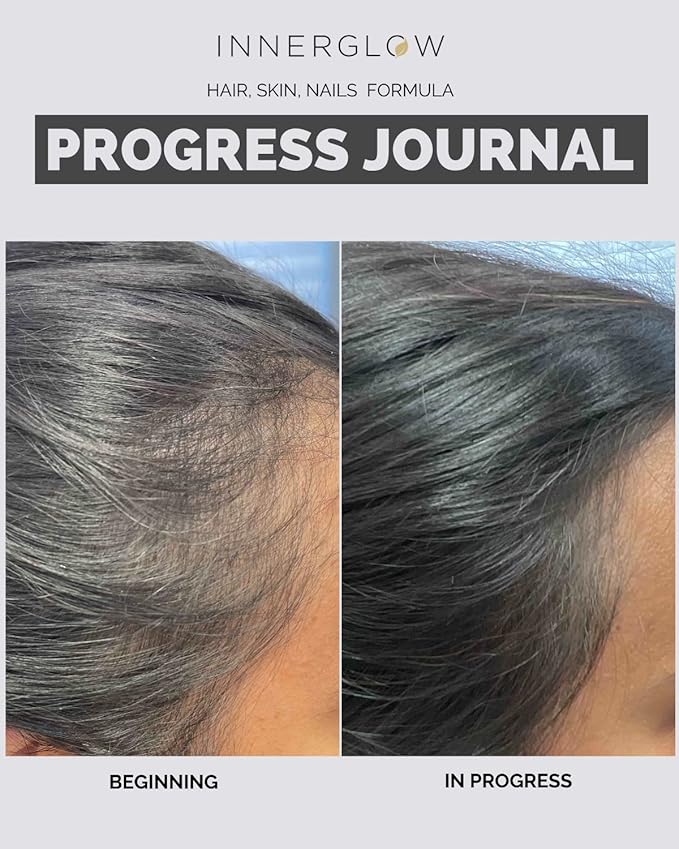 Advanced Hair, Skin & Nails Formula - Dermatologist and Plastic Surgeon Developed, clinically Tested for visibly Stronger and Thicker Hair in 12 Weeks