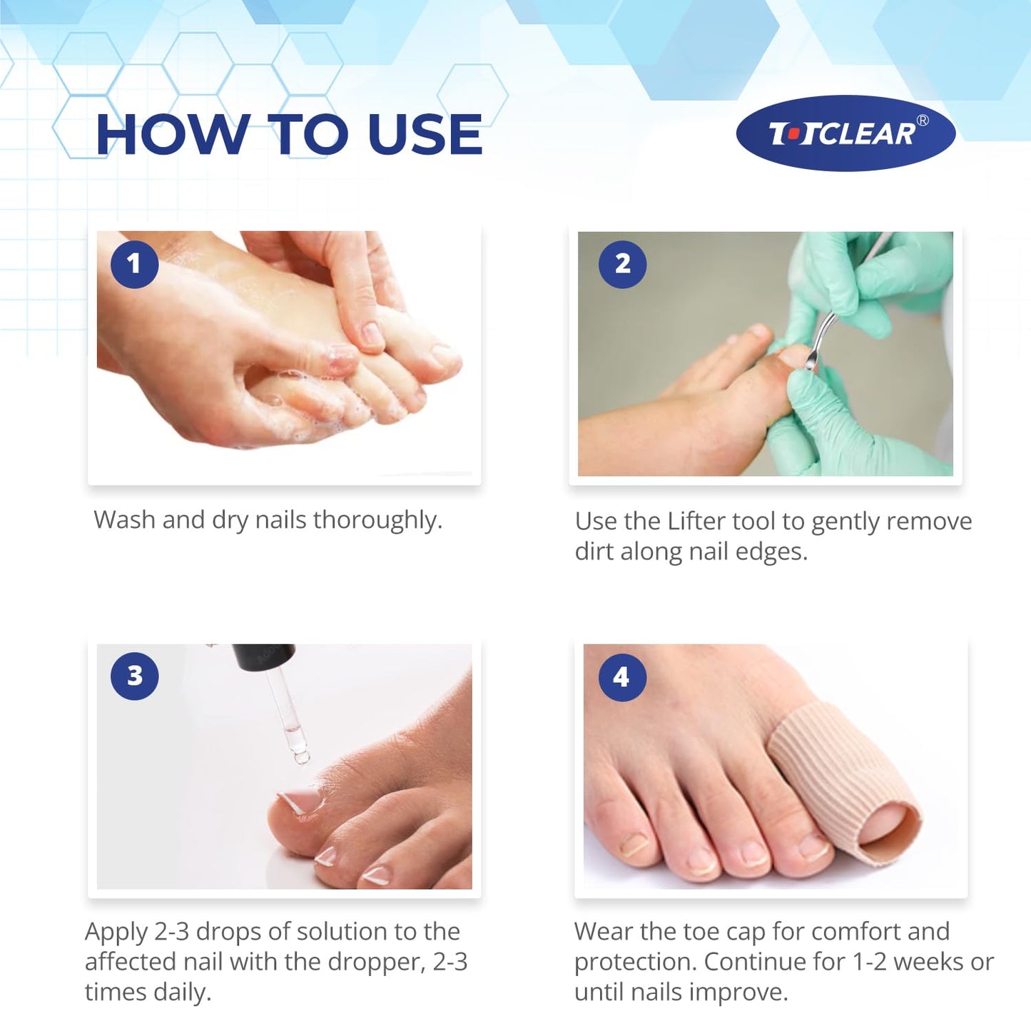 Ingrown Toenail Relief: Ingrown Toenail Tool for Men Women - Ingrown Toenail Removal Kit - Ingrown Toenail Corrector Drops - Ingrown Toenail Removal - Effective Solution for Ingrown Toenails - 30ml