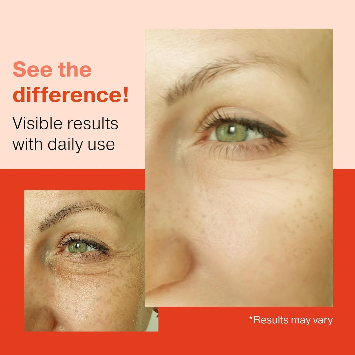 2X BIGGER 2oz, 1% Retinol Serum for Face, Dark Spot Remover, Anti Aging Serum, Retinol Cream, Aloe Vera, Rosemary, Calendula Extract, Made in USA