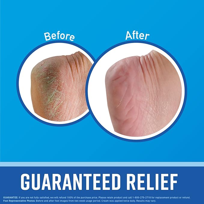 O'Keeffe's for Healthy Feet Foot Cream - 7 oz Tube (2 Pack) - Guaranteed Relief for Extremely Cracked, Dry Feet, Repairing Skincare, Instantly Boosts and Retains Moisture Levels