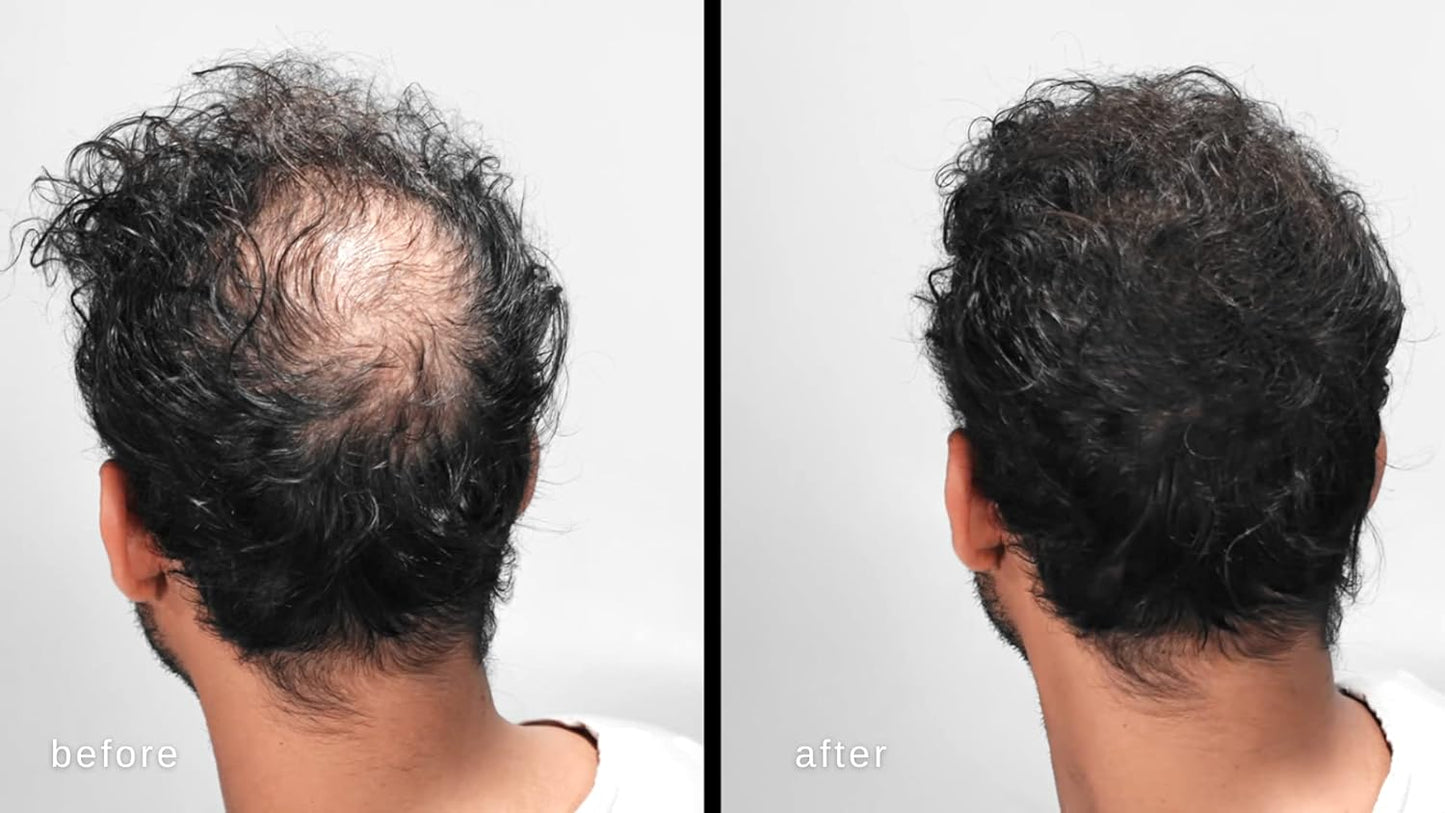 LUXE Hair Building Fibers - Thickening Fibers - CONFIDENCE IN A JAR – 2 Months+ Supply! – Hypoallergenic, Dermatologist Tested – Multiple Colors Available (Gray)