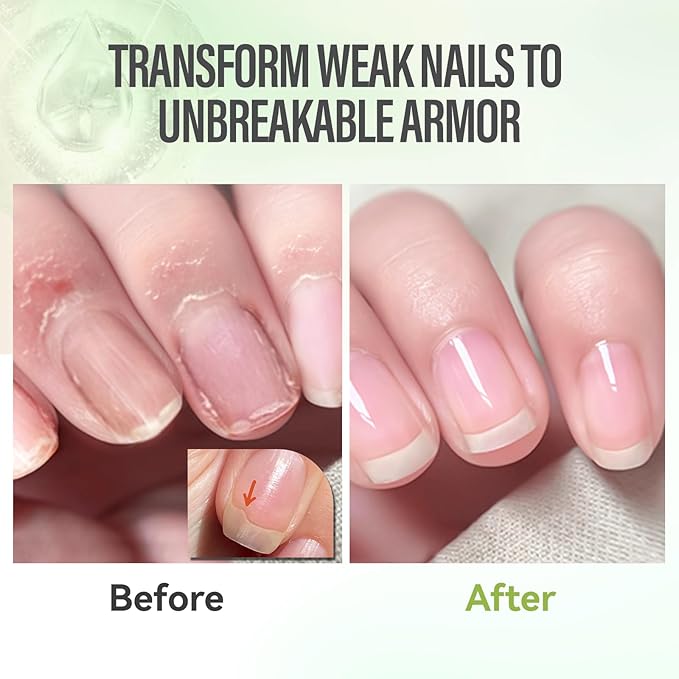 CHUCHU Nail Strengthener - Aloe Vera Nail Repair Growth Moisturizing Treatment - Natural Jojoba Vitamin B & E Cuticle Oil for Dry Cracked Nails