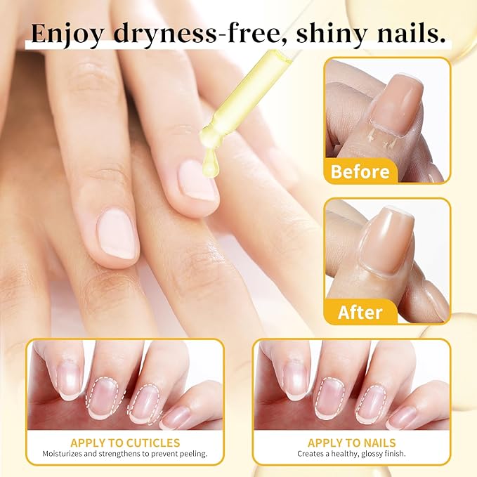 EJW Cuticle Oil for Nails, 1 Week Multi-Functional Care for Hands and Feet, Moisturizes & Strengthens Nails, Improves Hangnails & Dry Skin, Contains Jojoba Oil, Natural Ingredients, Milk and Honey