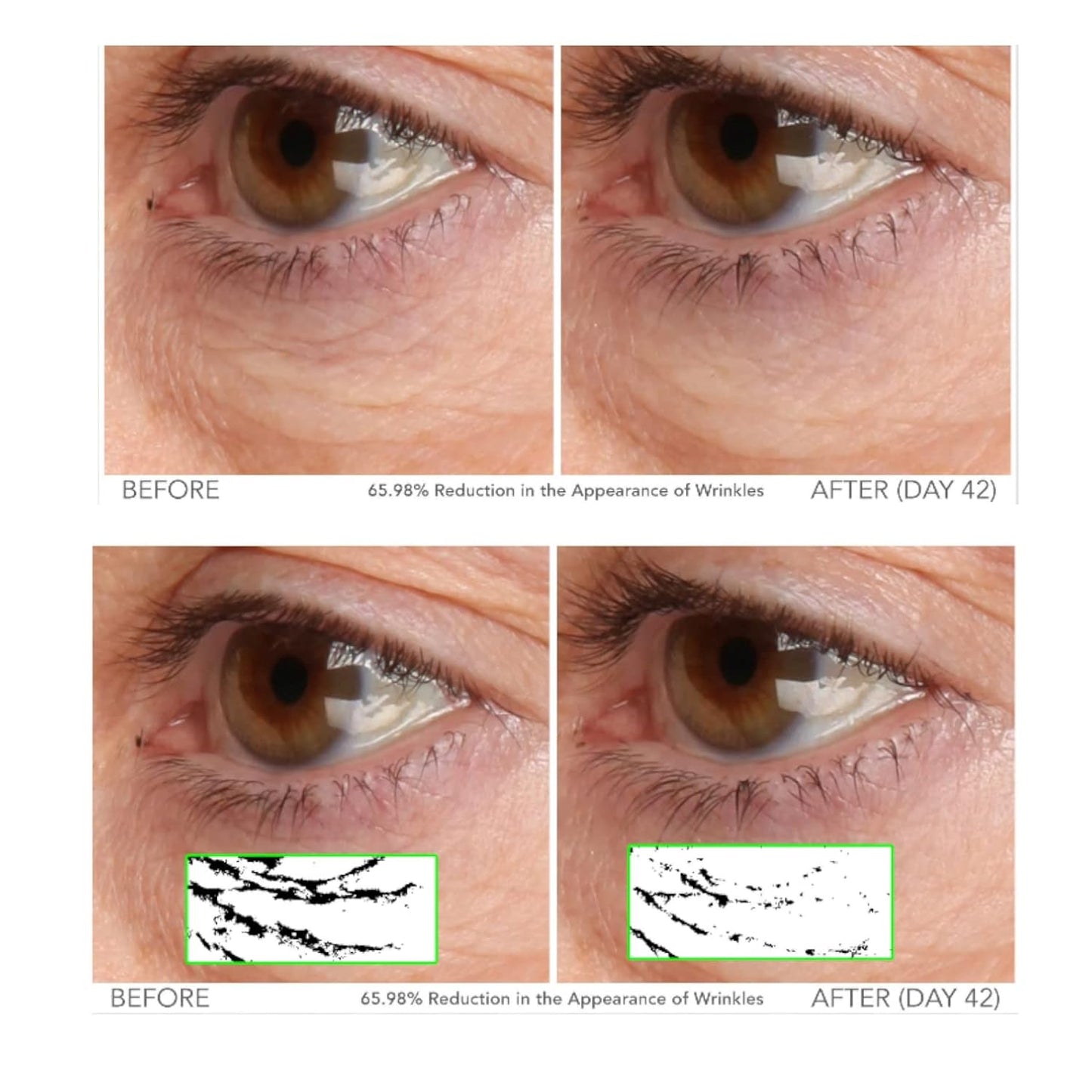 Serious Skincare - Beyond Intensive Vitamin C Serum for Face - 60 Day Facial Treatment for Healthy Glowing Skin and Brightening - Smoothes Lines, Pores and Fades Dark Spots - 2 Piece Anti-Aging Set