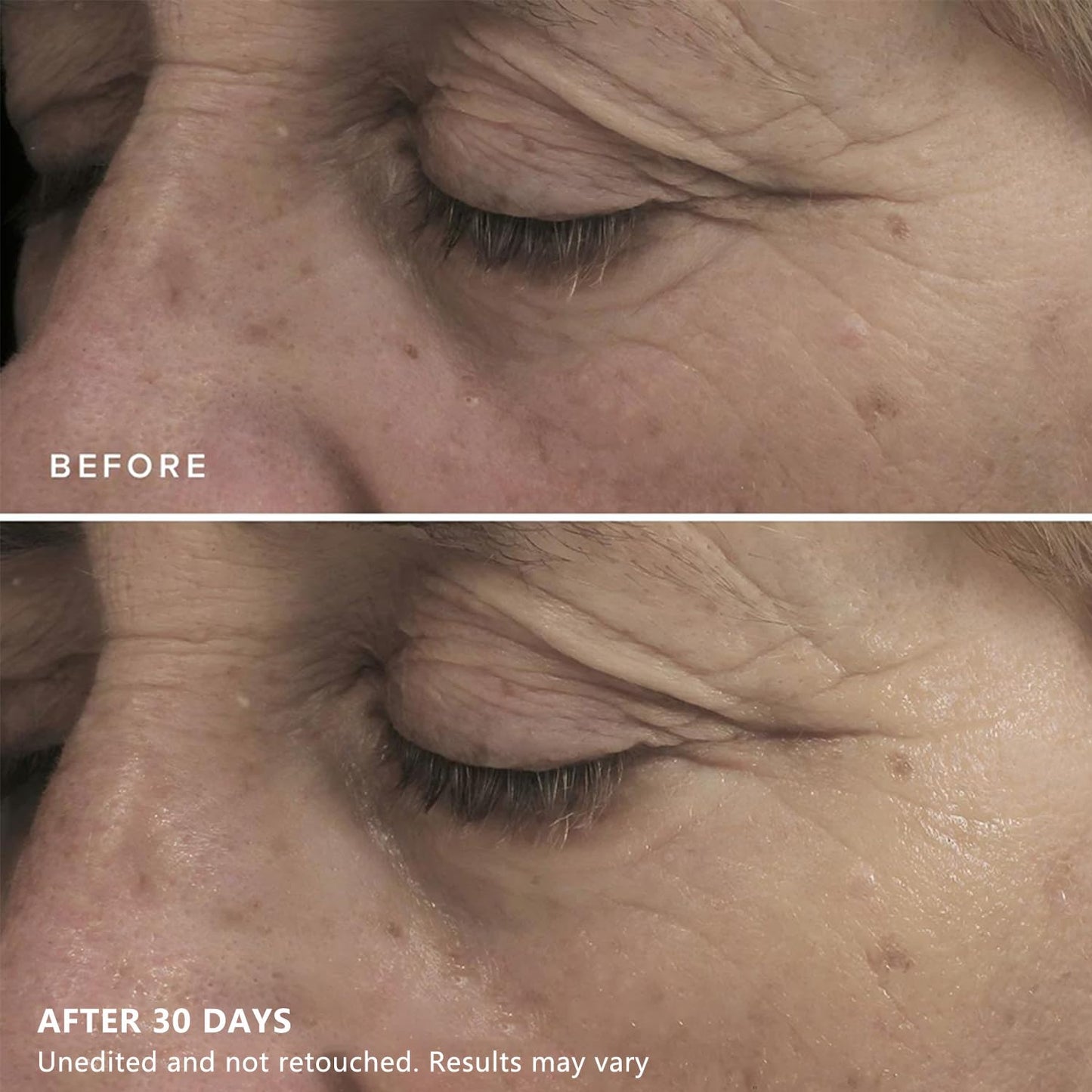 Brightening Eye Masks - Caffeine Eye Masks for Dark Circles and Puffiness with Hyaluronic Acid, Eye Patches for Puffy Eyes, 30 Pairs