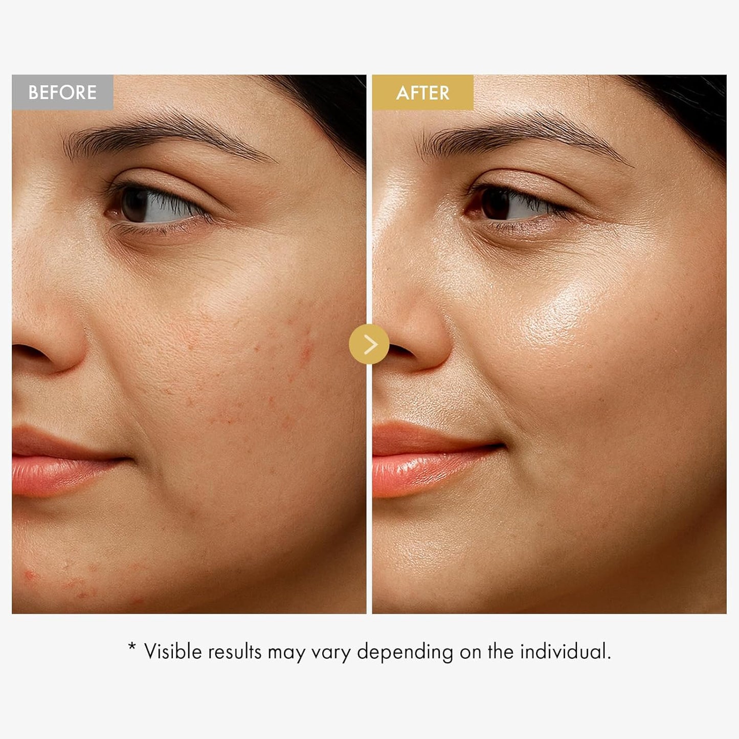 TOSOWOONG Glow Bean Face Cream, 63,844ppm Soybean Ferment Extract, Korean Skincare for Glass Skin, Moisturizer, Relief, Smooth, Nourished Skin, Anti-Aging, Hydrating, K Beauty, 50 ml / 1.69 fl. oz.