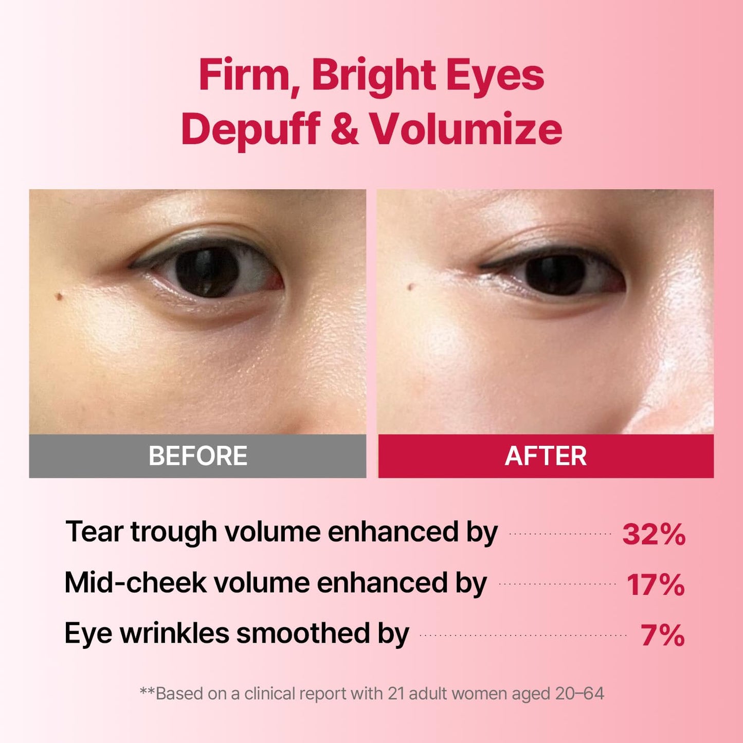 Wrinkle-fit Tangle Eye Patch - Under Eye Patches for Dark Circles and Puffy Eyes - Eye Bags Treatment for Women - Mega Collagen Gel Pads for Puffiness - Firming & Deep Hydrating - 4EA