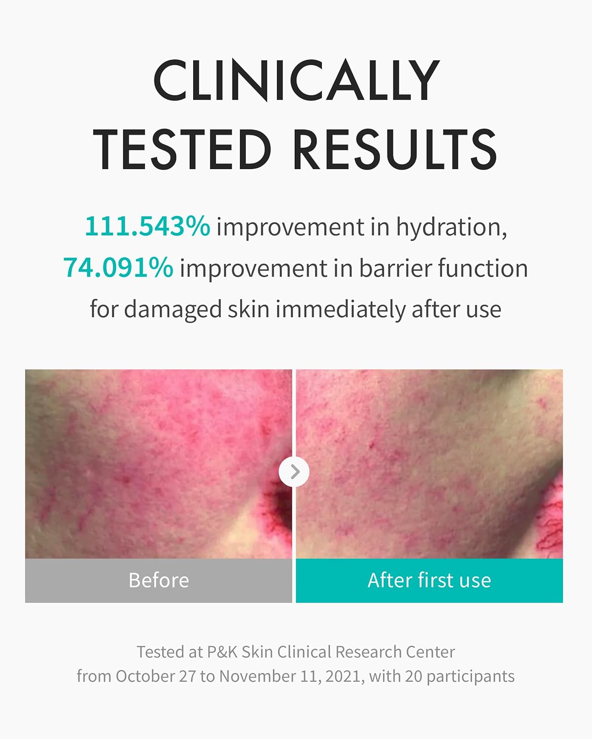 REJURAN® Moisture Treatment Ampoule, c-PDRN® - Deep Hydrating Face Serum for Instant & Long-Lasting Moisture, Soothing, Skin Barrier Boost, Moisture Lock with PDRx. Korean Skin Care (1.01 fl oz)