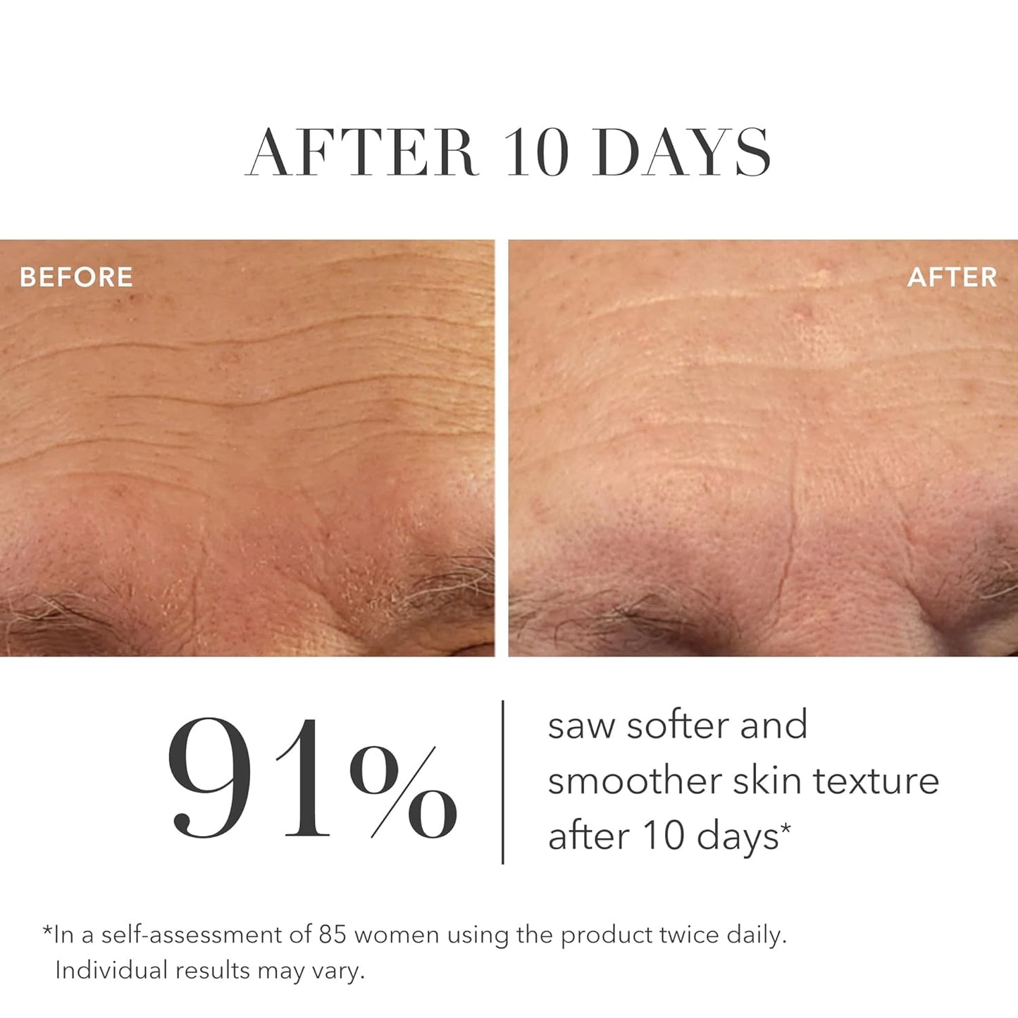 Algenist GENIUS Liquid Collagen Serum - Firming and Hydrating Face Serum with Collagen + Vitamin E - Helps Visibly Minimize Fine Lines + Wrinkles and Improve Elasticity (1 oz)