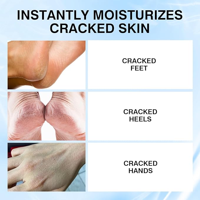 Professional Repair Heel Balm Stick for dry cracked feet treatment, intensive foot repair, moisturizes heels, deeply moisturizes and softens feet, refreshingly smooth non-greasy texture