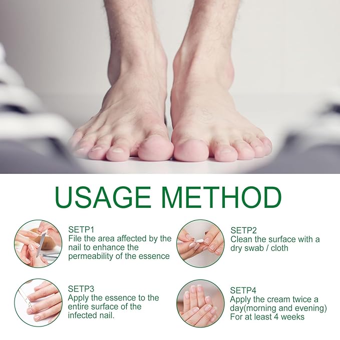 Ginger Nail Treatment Nail Support Nail Care, 7Days Nail Treatment Serum, Multi-Purpose Nail Repair