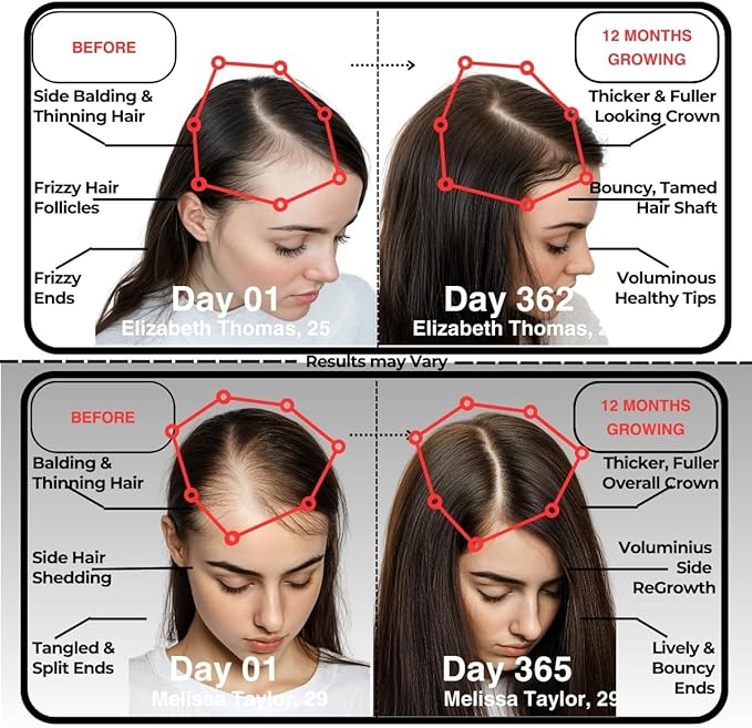 Hair Skin and Nails Vitamins, Hair Skin and Nails Gummies, Biotin Collagen Gummies, Biotin 5000mcg, Hair Vitamins, Collagen Supplements, Marine Collagen, Vitamin B12, Gifts for Women, GummBear