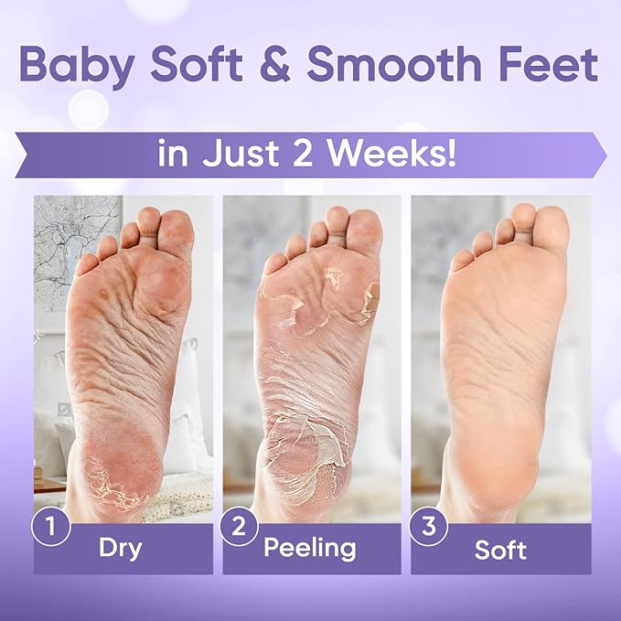 Foot Peel Mask - Foot Mask for Baby Soft Skin - Remove Dead Skin, Dry, Cracked Feet & Callus, Foot Spa, Made with Aloe Vera Extract for Women and Men (2 Pair (Pack of 1), Lavender)