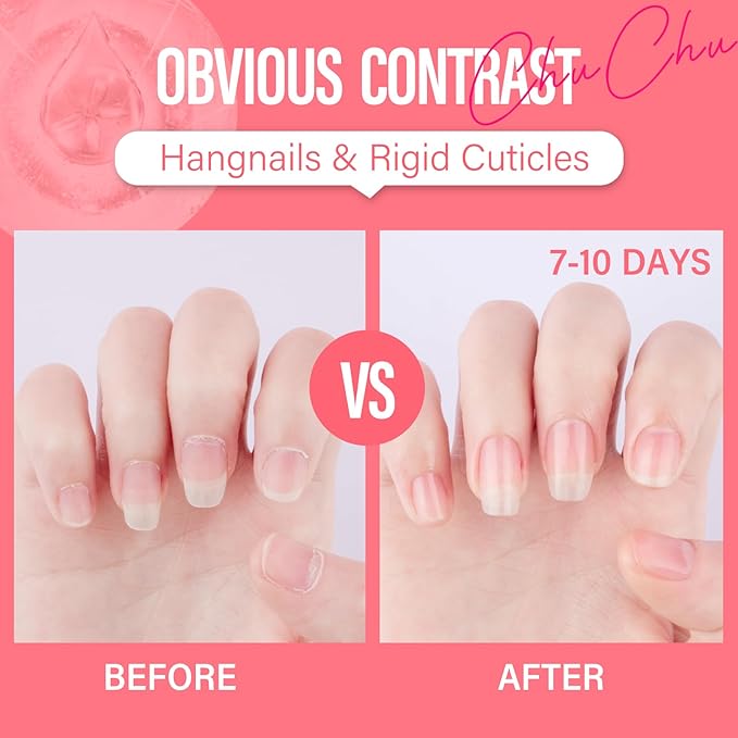 CHUCHU Jojoba Cuticle Oil for Nails: Watermelon Organic Nail Oil with Vitamin B & E - Moisturizes Repairs and Promotes Nail Growth - Prevents Dryness Hangnails and Chapped Skin 15ML