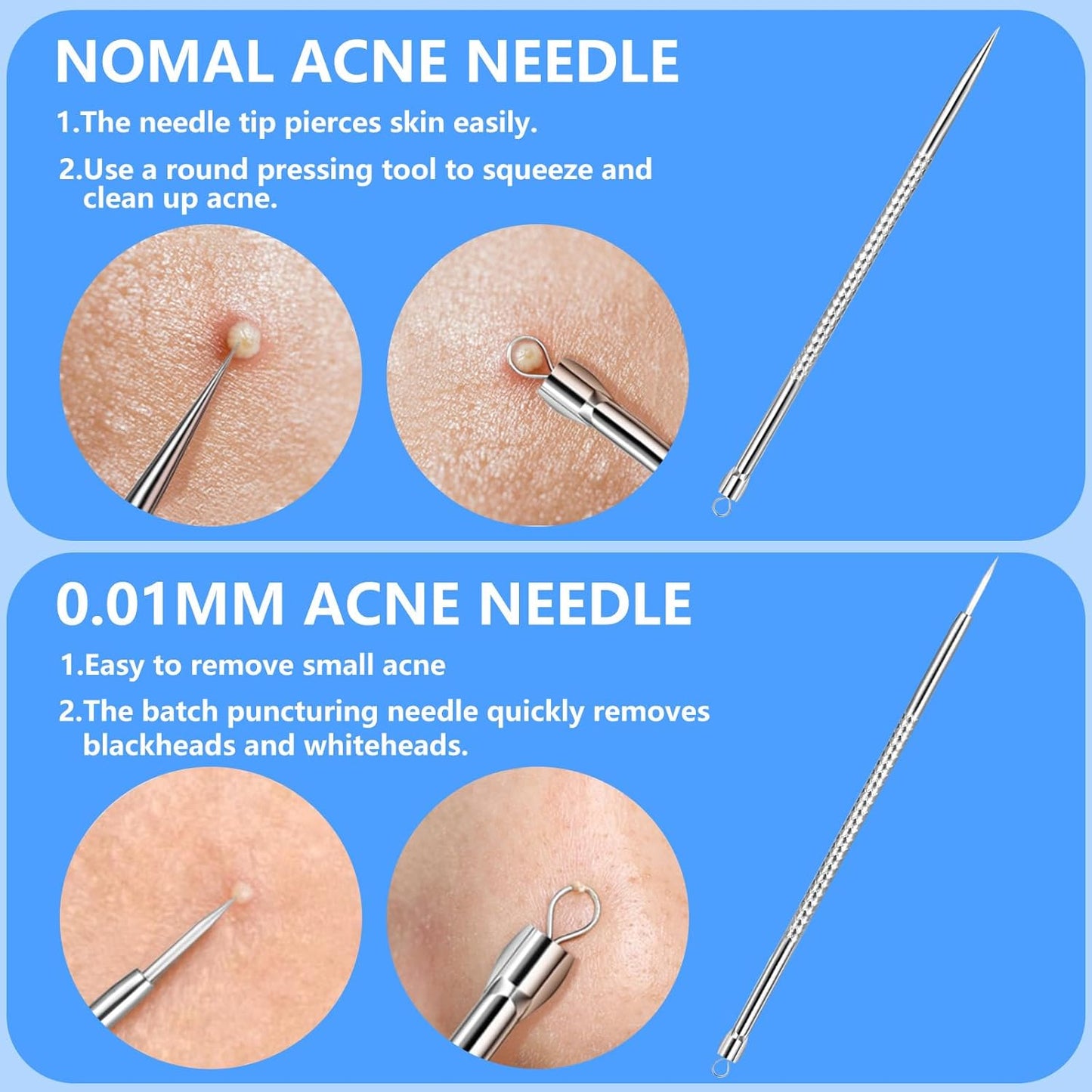 5PCS Blackhead Remover Comedone Extractor Kit - Professional Stainless Steel Tools for Pimple, Acne, and Blemish Removal - Curved Tweezers Included