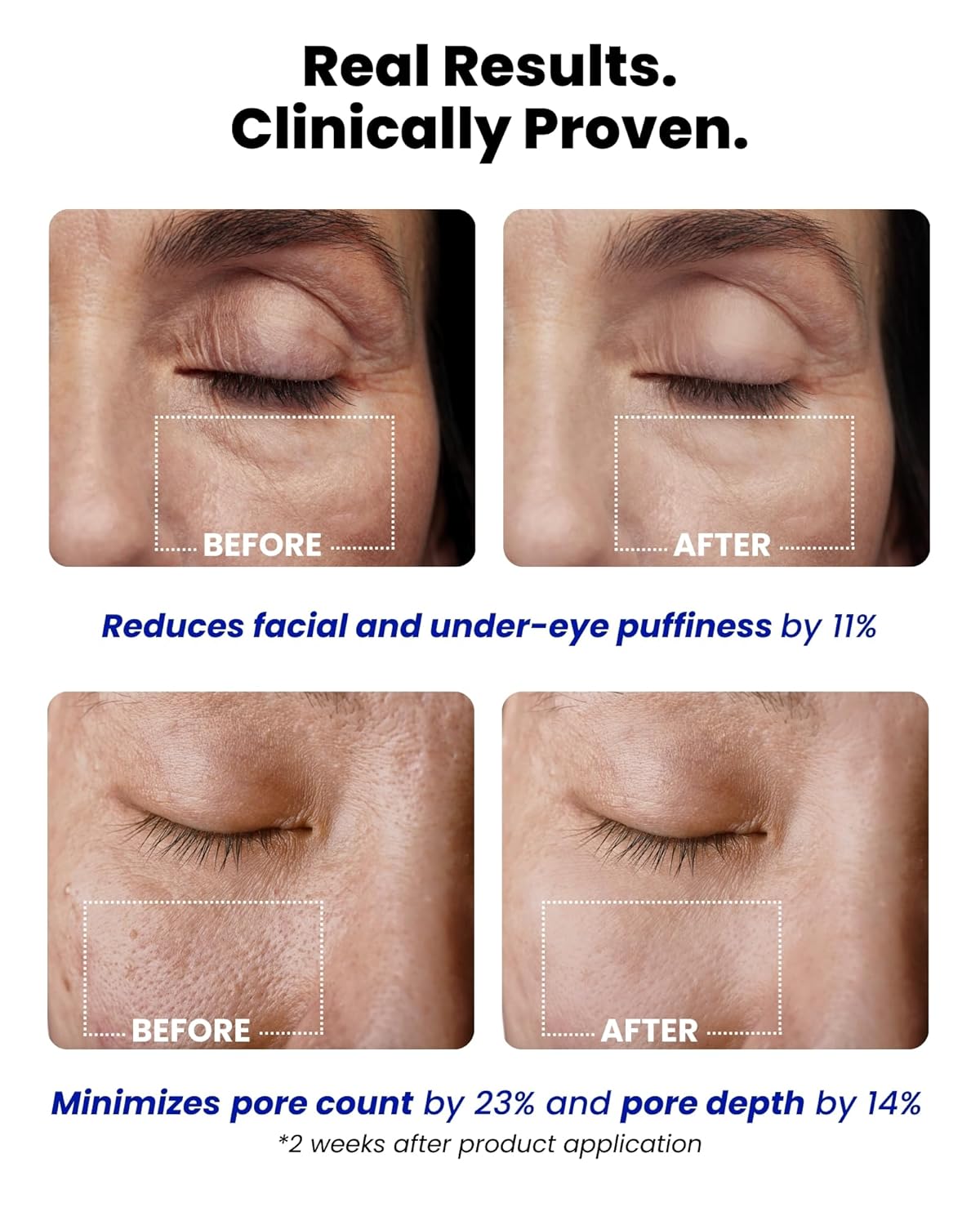 Ice Roll Serum - Cooling Serum with Face Massager Roller for Under Eye Bags, Puffiness, Dark Circles, Hydrating & Pore Minimizing with Panthenol, Tannin - Korean Skin Care, 1.69 Fl Oz (50ml)