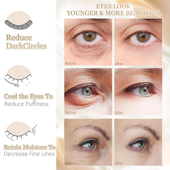MOND'SUB Under Eye Mask - 6 Pairs Orange Crystal Eye Mask for Sleeping- Puffy Eyes & Dark Circles Treatments with Hyaluronic Acid, Reduce Under Eye Bags and Smooth Wrinkles, Brighten Complexion