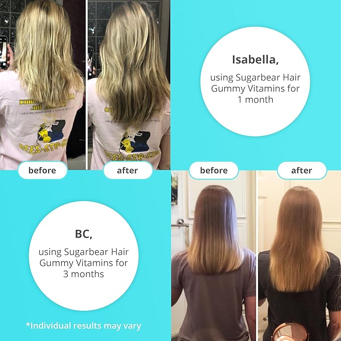 Sugarbear Hair Vitamin Gummy 1 Month Supply Extra Strength Biotin 6000mcg, Growth for Men & Women, Vegan Vitamin B12, MSM, Inositol, Omega 3, Elderberry, Certified Kosher, Halal, Cruelty-Free