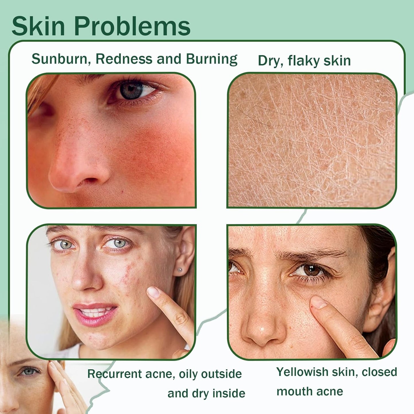 Moisturizing Gel for Face & Body,Non-sticky Gel After Sun Aloe Lotion Skin Care,Fast Absorbing Long Lasting Refreshing Hydrating Face Moisturizer for All Skin Types E