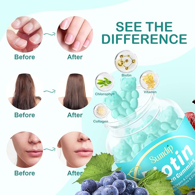 Biotin Gummies, Biotin 10,000mcg with Collagen Gummies for Hair Growth, Chlorophyll, Vatimin A, B6, B12, C, D, E, Vegan Natural Hair Skin and Nails Gummies for Men Women - 2 Packs