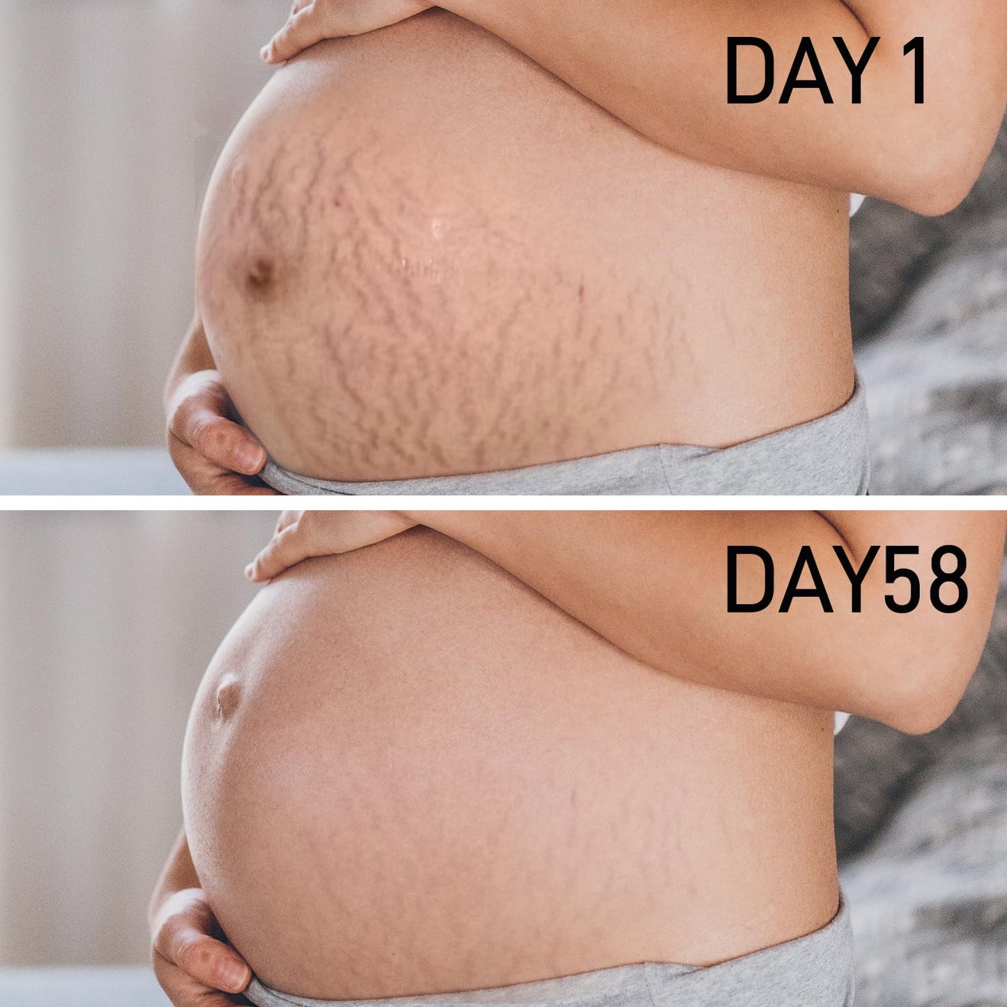 PEGO Stretch Mark Oil for Pregnancy, Maternity Body Oil for Stretch Mark Prevention & Reduction, Hydrating Skin Care, 4.06oz (2Pack)