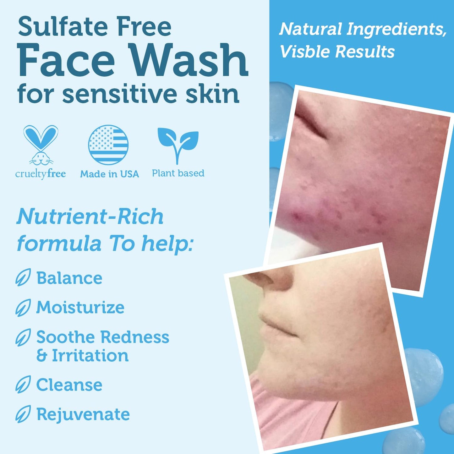 Era Organics Manuka Honey Face Wash for Sensitive Skin - Sulfate Free Gentle Cleanser with Organic Aloe Vera, Hyaluronic Acid & More - Soothing & Moisturizing for Dry Skin - Made in USA (4 oz)