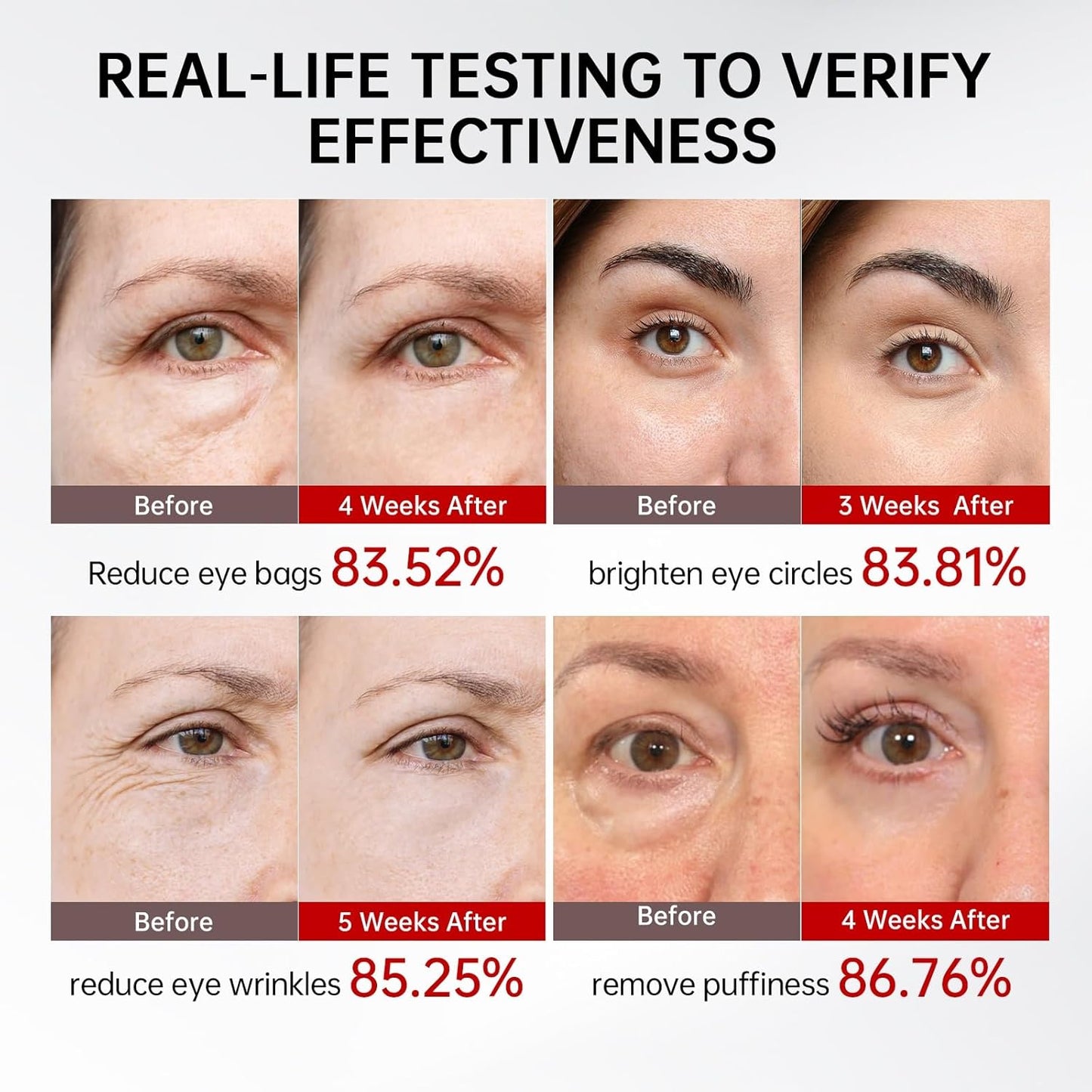 Retinol & Caffeine Eye Serum -360° Massage Roller for Puffiness,Eyebag Remover,Wrinkle Filler,Under Eye Cream For Dark Circles 0.54fl.oz (Pack of 1)