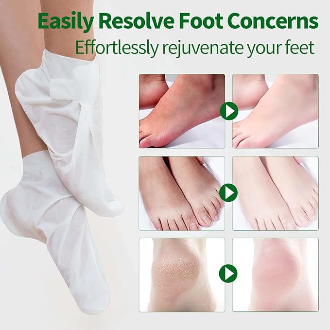 Moisturizing Foot Mask 5 Pack,Hydrating Foot Masks for Dry Cracked Feet,Moisturizing Socks Dry Skin Moisturizer for Soft and Smooth Touch Feet,Foot Care Spa Gifts for Women Men Mother's Day Gifts