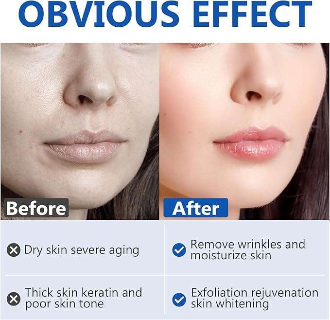 Hyaluronic Acid Powder for Face & Skin | Deep Hydration & Wrinkle Reduction | Pure Hydrating Powder for DIY Face Masks, Serums & Lotions