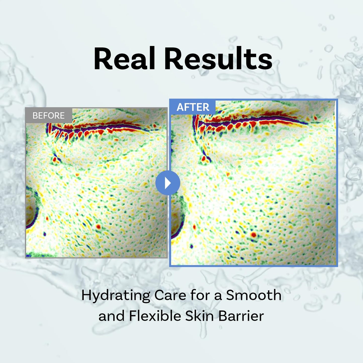 APOTHE Exosome Squal-Tox Booster Cream Mist 3.38 fl oz (100ml) – Hydrating, Soothing, and Brightening with Squalane, Centella Asiatica, and Niacinamide