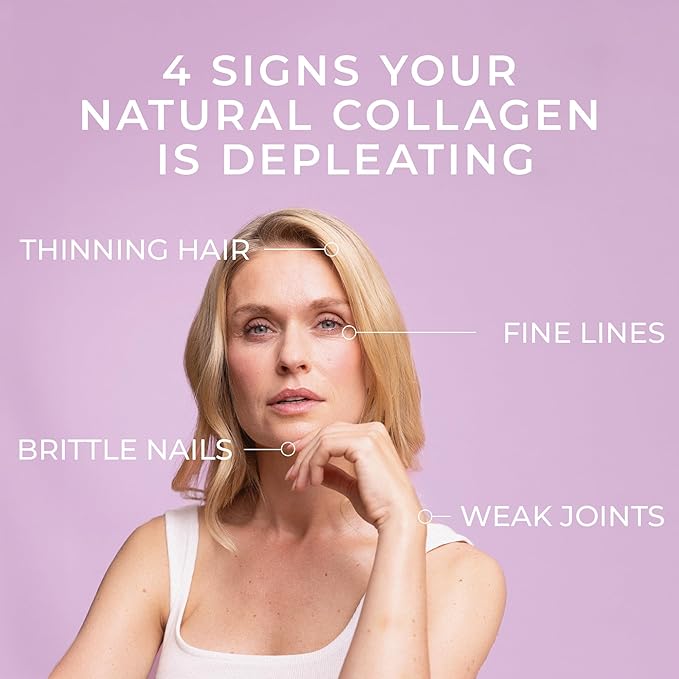 Swedish Collagen - Hydrolyzed Marine Collagen 10,000 mg Powder Supplement - Pack of 300 g, 30 Day Supply | Pure Peptide to Support Healthy Hair, Skin, Nails and Joints I 100% Natural and Gluten Free