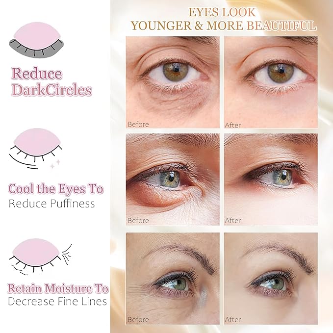 MOND'SUB Under Eye Mask - 6 Pairs Orange Crystal Eye Mask for Sleeping- Puffy Eyes Dark Circles Treatments with Hyaluronic Acid, Reduce Under Eye Bags and Smooth Wrinkles, Brighten (Cranberry)