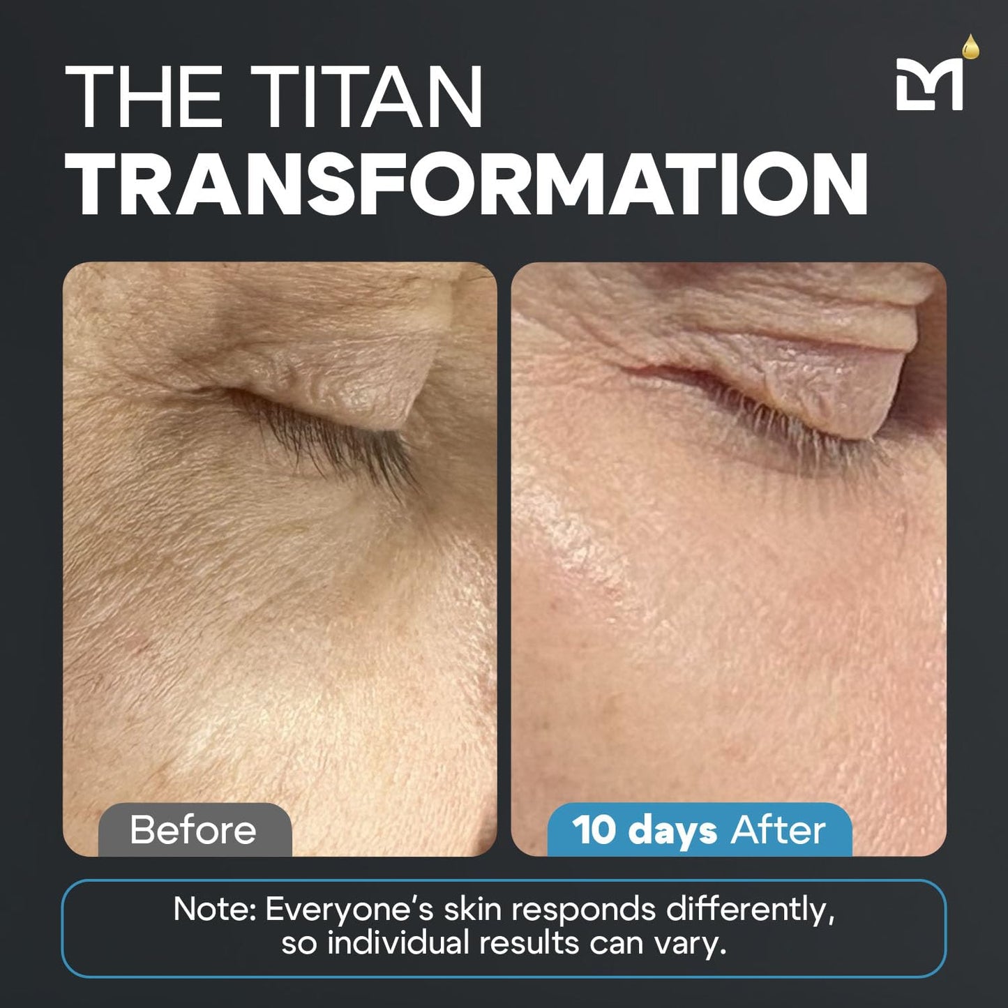 Titan Anti-Aging Mens Face Wash – For Men, Cleanse, Hydrate, Revitalize – Gentle Exfoliating Face Cleanser – Men, Skin Care – Herbal Extracts, Ceramides, Peptides, All Skin Types – Unscented