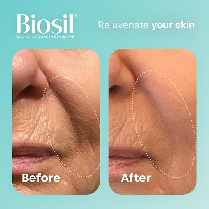 Biosil Collagen Generator - 1 fl oz Drops, Pack of 2 - with Patented ch-OSA Complex - Generates & Protects Your Own Collagen - GMO Free - 120-Day Supply