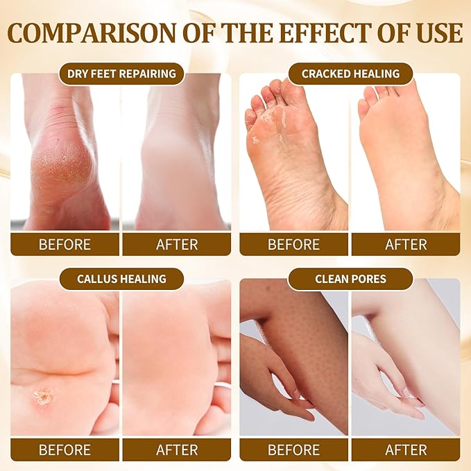 Pedicure Kit Foot Soak Set: Bubble Salt, Sugar Scrub, Massage Mask, Massage Lotion in a Box, 4 Step Foot Spa Kit for Dry Feet,Tired Feet（3 Set Golden petals)