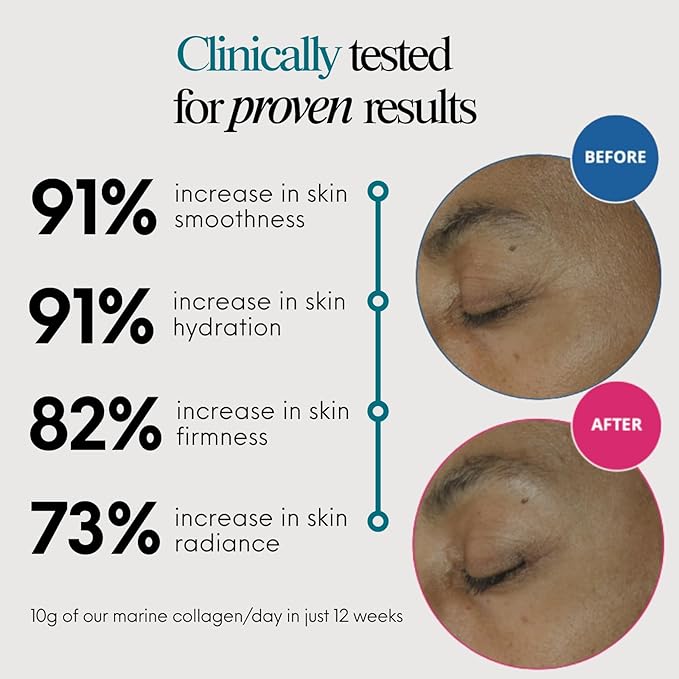 ENSANTE Premium Marine Collagen Peptides Powder Unflavored, Type I II III IV Clinically Backed Wild-Caught Fish Collagen with Organic Camu Camu Vitamin C for Hair Skin Nails Joint, Lab Tested Easy Mix