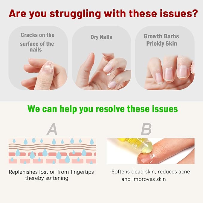 Cuticle Oil - Repaired Dryness Damaged Nails and Cuticle, Moisturizes, and Strengthener for Nails Care, 6 Bottle/10ml Rollerball