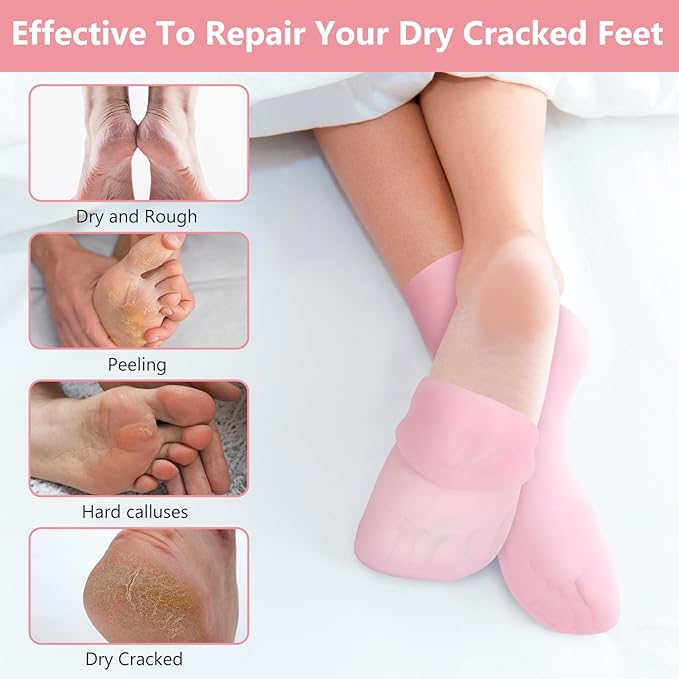 Silicone Socks for Dry Cracked Feet 2 Pairs,XL Moisturizing Socks Non-Slip Moisturizing Heel Socks for Dry Cracked Feet Women Ultra-high Stretch Foot Care Pedicure Socks for Men(Pink,XL)